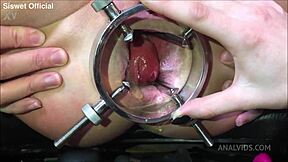 Are they destroying my asshole with fisting? See my belly bulge in this teen 18+ lesbian anal vid!