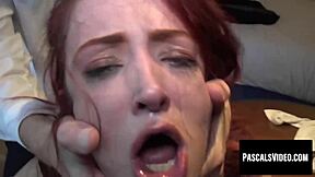 naughty developing redheads like andi rye visit pascal white for vaginal restructuring